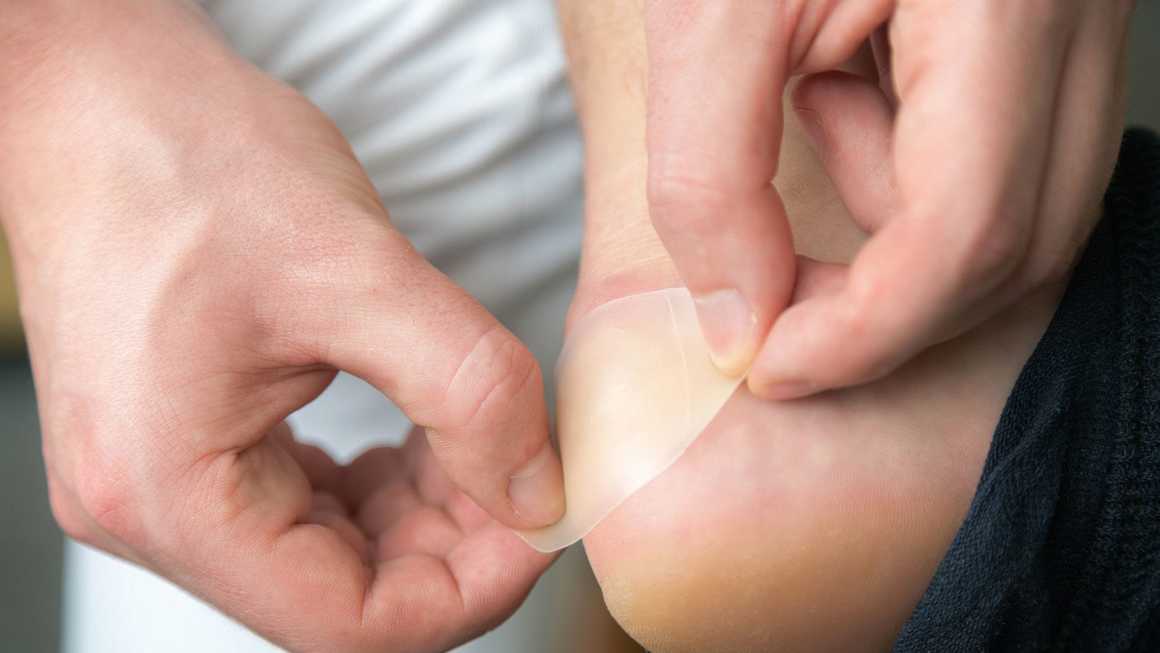 Adding blister plaster