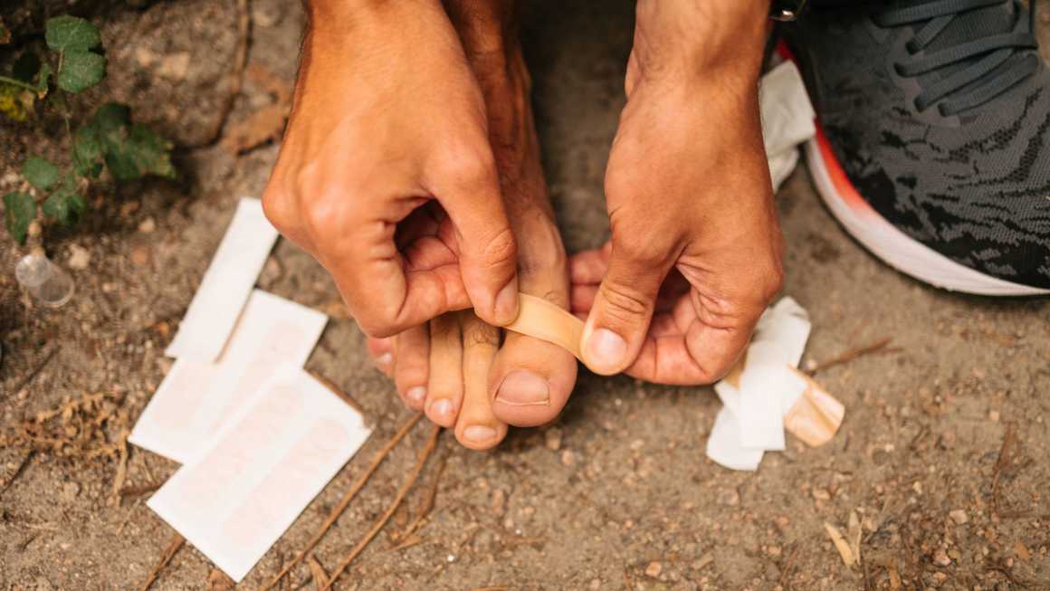 Adding plaster to blister